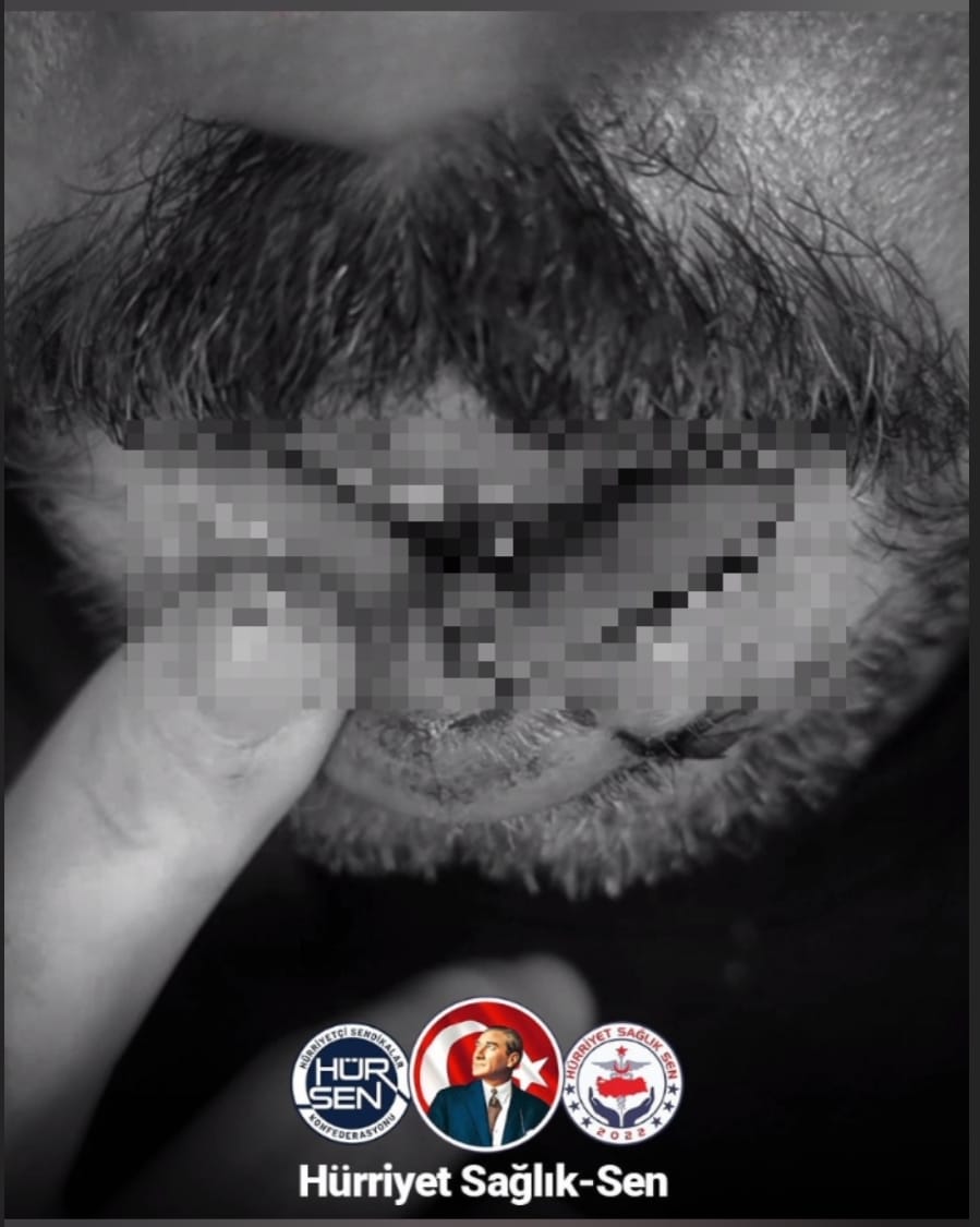 ŞANLIURFA’DA SAĞLIKTA YİNE DEHŞET: