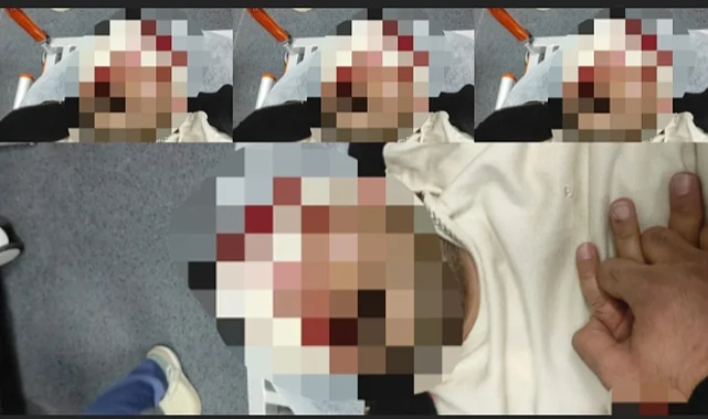 Şanlıurfa’da İntihar Girişimi: Bir Kişi Ağır Yaralandı